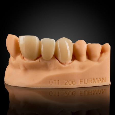 Cut-Back Zirconia Cut-Back Zirconia