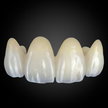 Esthetic Multilayer Zirconia Esthetic Multilayer Zirconia