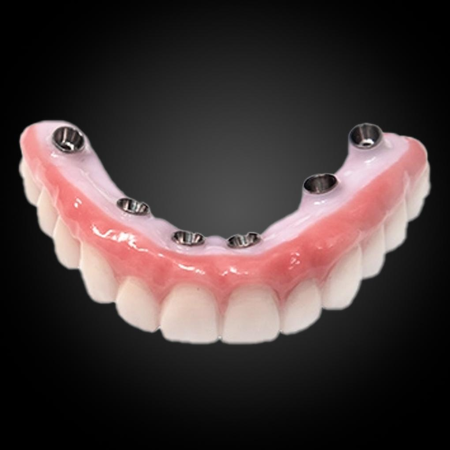 Phục Hình Toàn Hàm Trên Implant Phục Hình Toàn Hàm Trên Implant