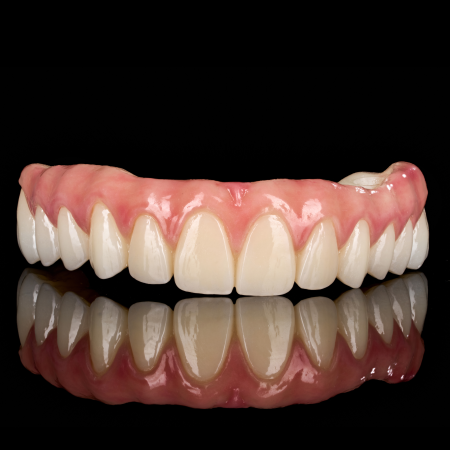 Phục hình Zirconia Toàn hàm Phục hình Zirconia Toàn hàm