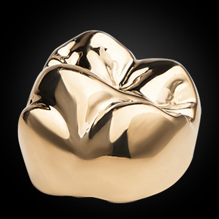 Full Cast Gold Crown Full Cast Gold Crown