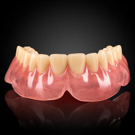Full Denture Full Denture
