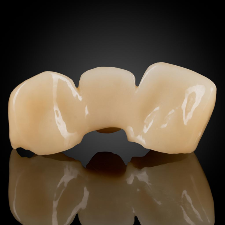 Monolithic Zirconia Monolithic Zirconia