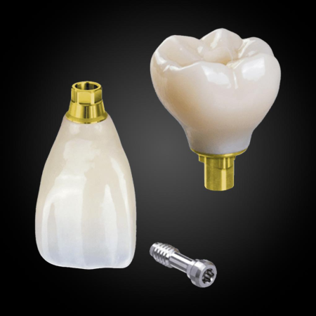Phục Hình Bắt Vít Trên Implant Phục Hình Bắt Vít Trên Implant