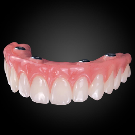 Phục Hình Tháo Lắp Trên Implant Phục Hình Tháo Lắp Trên Implant