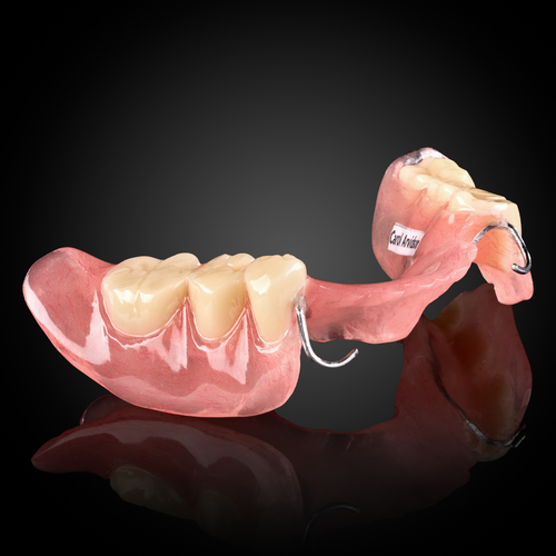 Acrylic Partial Denture Acrylic Partial Denture