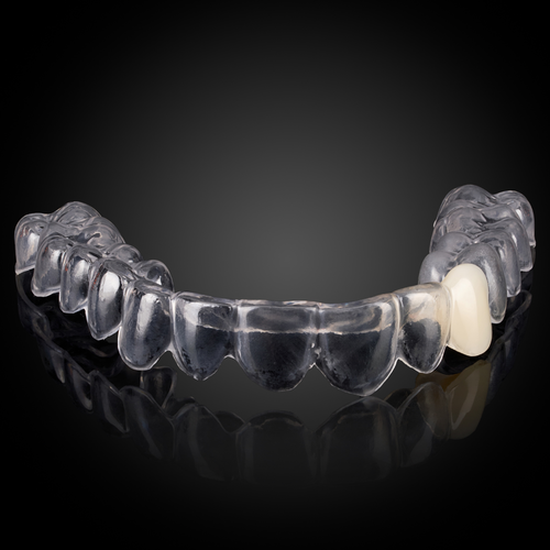 Clear Essix Partial Denture Retainer Clear Essix Partial Denture Retainer