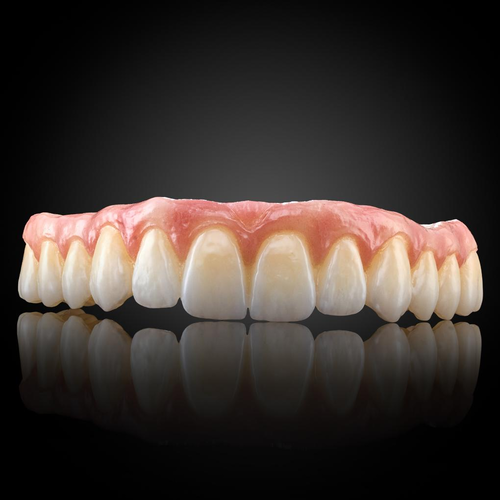 Phục Hình Thẩm Mỹ Toàn Hàm Trên Implant