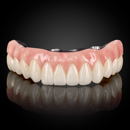 Esthetic Full Arch Implant Esthetic Full Arch Implant