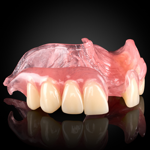 Flexible Partial Denture Flexible Partial Denture