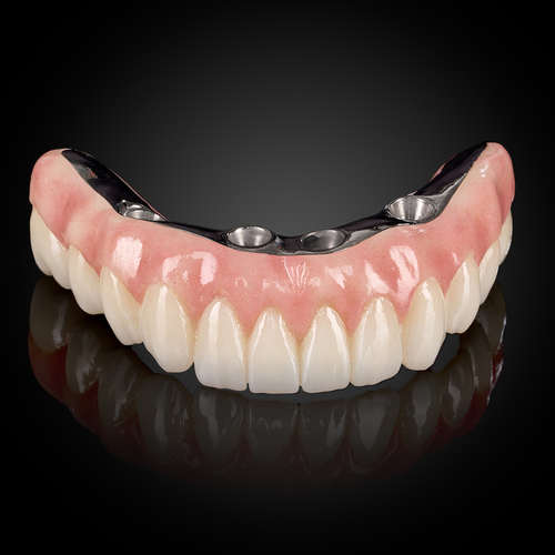 Phục Hình Toàn Hàm Trên Thanh Bar