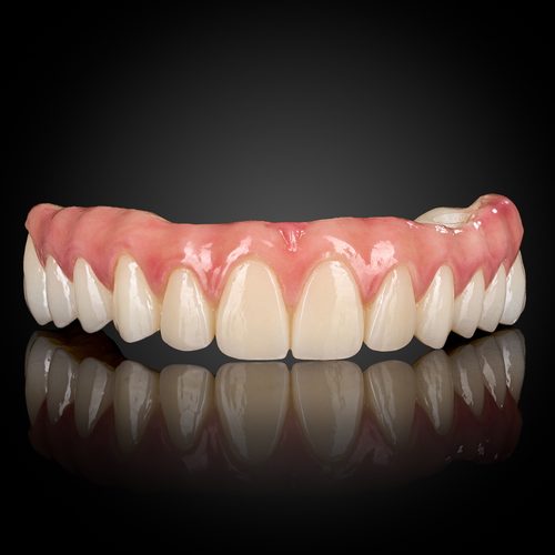 Full Arch Implant Full Arch Implant