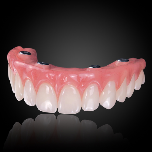 Implant-Retained Hybrid Dentures Implant-Retained Hybrid Dentures