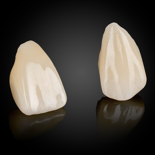 Layered Zirconia Layered Zirconia