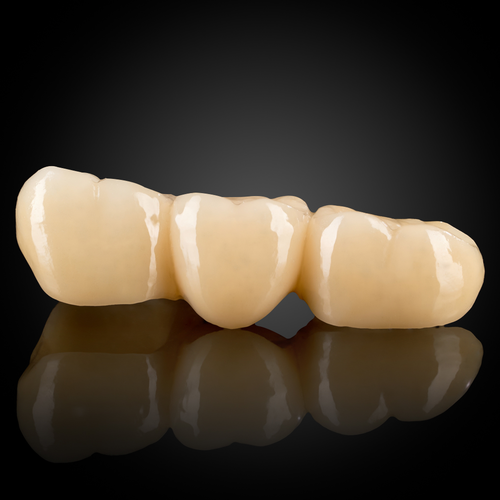 Monolithic Zirconia Monolithic Zirconia