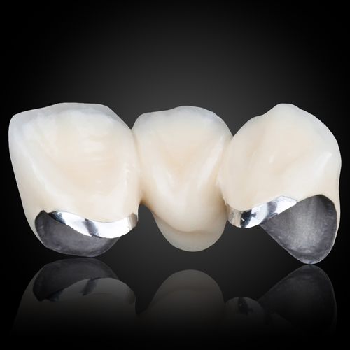 Phục Hình Sứ Kim Loại PFM Phục Hình Sứ Kim Loại PFM