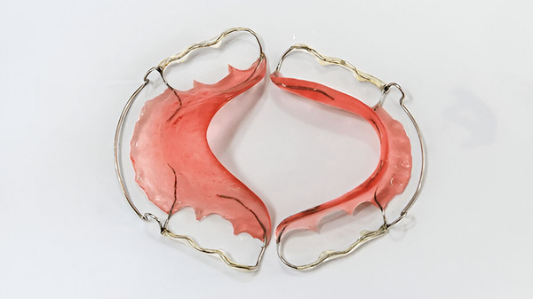 Gold Orthodontic Wires: From History To High-Tech Applications Gold Orthodontic Wires: From History To High-Tech Applications