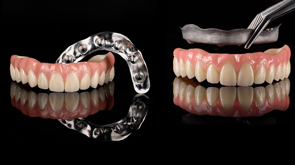 How Full Arch Hybrid Bars Are Reshaping The Business Of Modern Dental Labs? How Full Arch Hybrid Bars Are Reshaping The Business Of Modern Dental Labs?
