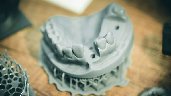 Stereolithography (SLA) In Dental 3D Printing: Academic Review, Clinical Applications & Workflow Integration