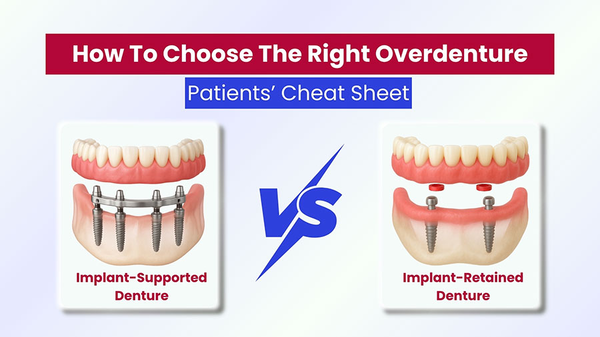 Implant-Supported vs Implant-Retained Dentures: What’s the Difference?