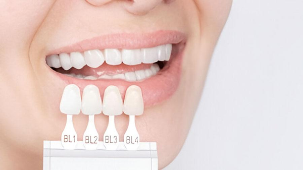 Standards Of Aesthetic Porcelain Teeth Standards Of Aesthetic Porcelain Teeth