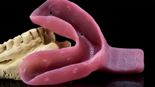 Distance Between The Border Of The Custom Tray For Full Dentures And The Depth Of The Vestibule Distance Between The Border Of The Custom Tray For Full Dentures And The Depth Of The Vestibule