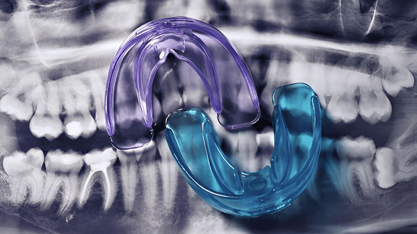 Modern Resin-Based Material: Revolution In Night Guard Technology