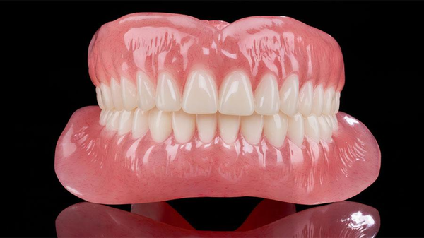 The Correct Shaping And Adjustment Of The Floor Of The Mouth In Removable Denture Fabrication The Correct Shaping And Adjustment Of The Floor Of The Mouth In Removable Denture Fabrication
