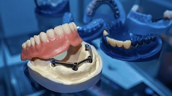 What Are The Different Types Of Removable Dentures? What Are The Different Types Of Removable Dentures?