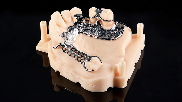 Overview Of Metal-Based Frameworks In Dental Prosthetics Overview Of Metal-Based Frameworks In Dental Prosthetics