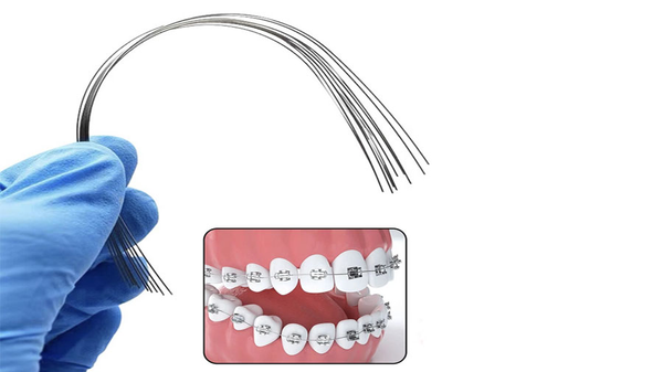 Ứng Dụng lâm Sàng Của Dây NiTi Siêu Đàn Hồi Trong Chỉnh Nha Hiện Đại Ứng Dụng lâm Sàng Của Dây NiTi Siêu Đàn Hồi Trong Chỉnh Nha Hiện Đại