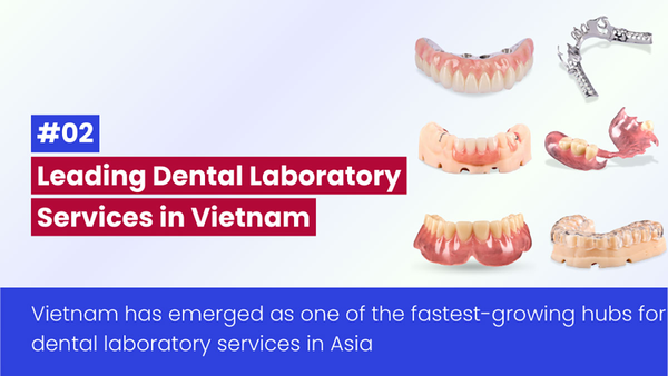 Top Labo Nha Khoa Hàng Đầu Việt Nam – Dịch Vụ Labo Nha Khoa Uy Tín Tại Việt Nam