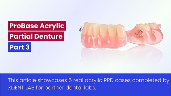Acrylic Partial Denture Case By Vietnam Dental Lab – Outsourcing Service - Part 3