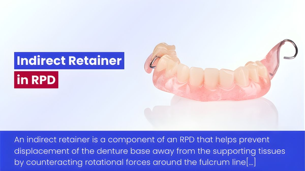 Indirect Retainer In Removable Partial Denture (RPD): Definition, Function, And Clinical Importance