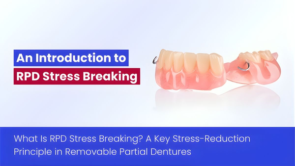 An Introduction To RPD Stress Breaking