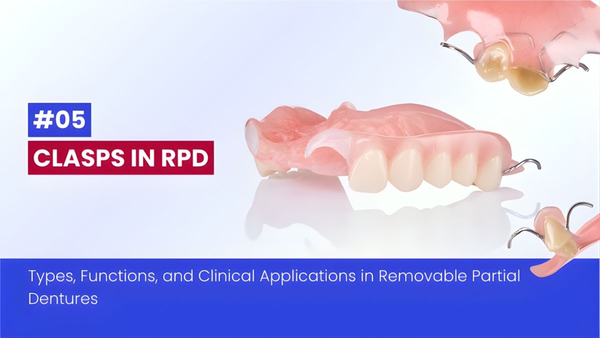 CLASPS IN RPD: Types, Functions, And Clinical Applications In Removable Partial Dentures