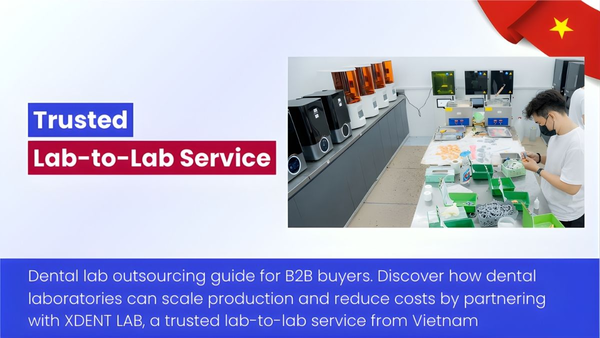Dental Lab Outsourcing By XDENT LAB - A Trusted Lab-to-Lab Service From Vietnam