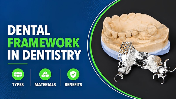 Dental Framework In Dentistry: Types, Materials, And Benefits