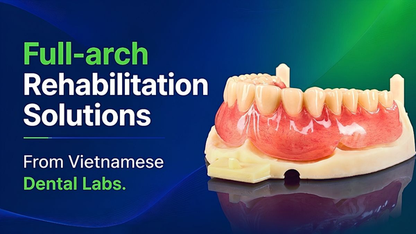 Full-Arch Rehabilitation Solutions From Vietnamese Dental Labs