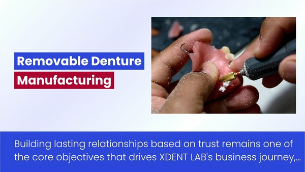 Labo Nha Khoa Hàng Đầu Tại Châu Á – XDENT LAB Và Hành Trình Xây Dựng Năng Lực Sản Xuất Phục Hình Tháo Lắp
