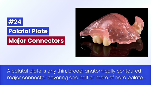 Connector Dạng Bản Khẩu Cái Trong Hàm Giả Bán Phần Tháo Lắp