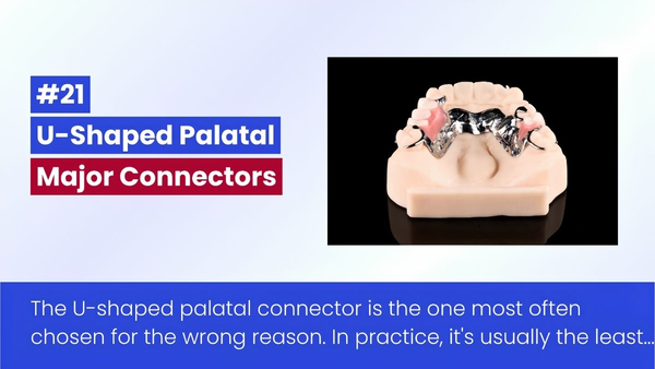 The U-Shaped Palatal Connector In Removable Partial Denture