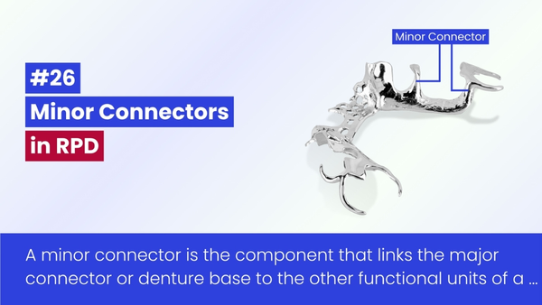 An Overview of Minor Connectors in Removable Partial Denture