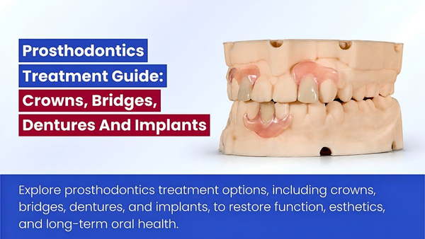 Prosthodontics In Dentistry: Types, Treatments And Benefits