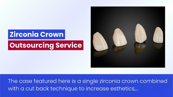 Zirconia Crown Case By Vietnam Dental Lab – Outsourcing Service
