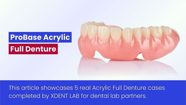 Acrylic Full Denture Photos By Vietnam Dental Laboratory