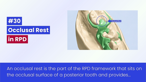 Ba Loại Rest Mặt Nhai Trong Hàm Giả Bán Phần Tháo Lắp