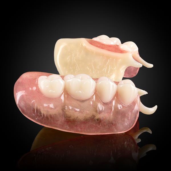 Acetal Framework Partial Denture