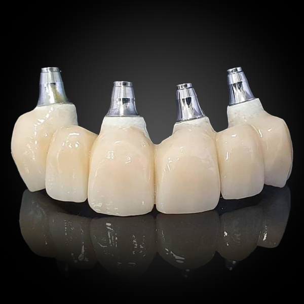 Cemented Implant Crown & Bridge