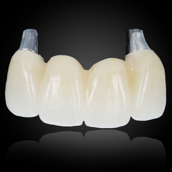 Cemented Implant Crown & Bridge